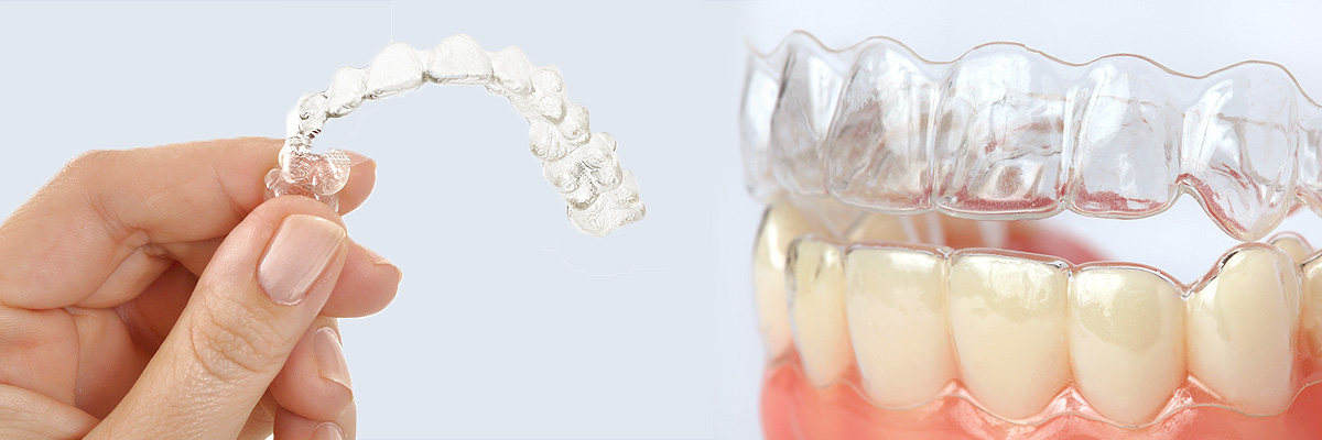Englewood Alternative to Braces for Teens