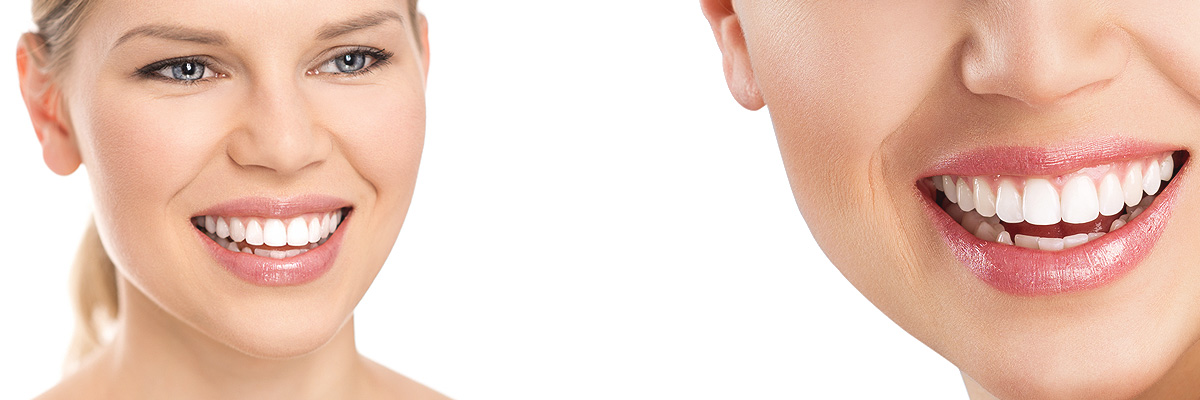 Englewood Cosmetic Dental Services