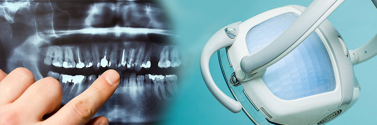 Englewood Dental Cleaning