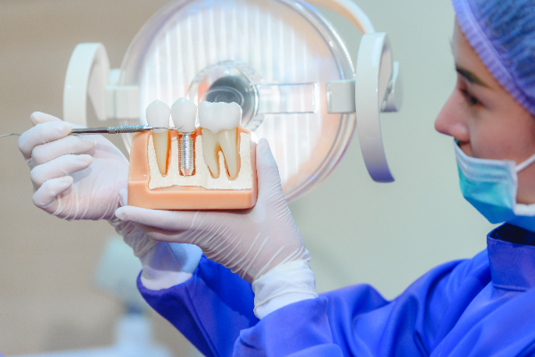 Are Dental Implant Follow Up Visits Needed?