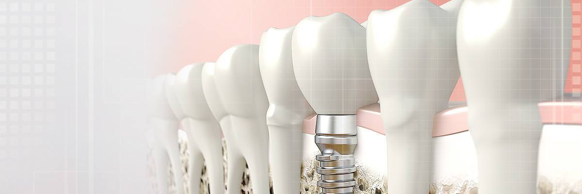 Englewood Dental Prosthetics