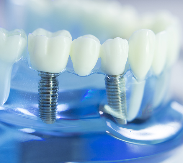 Englewood Dental Implants
