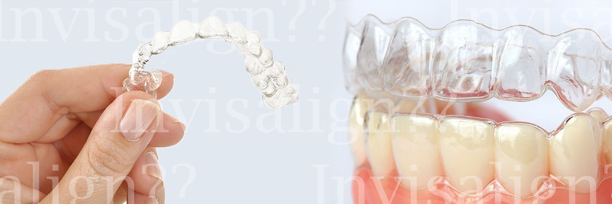 Englewood Does Invisalign® Really Work?