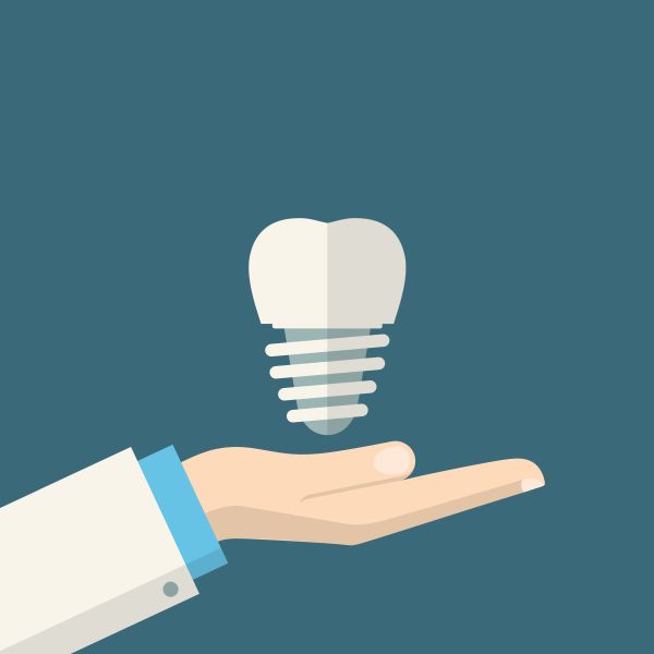 Dental Implant Professional FAQs