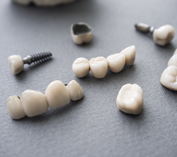 Englewood The Difference Between Dental Implants and Mini Dental Implants