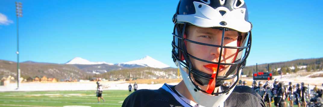 Englewood Mouth Guards