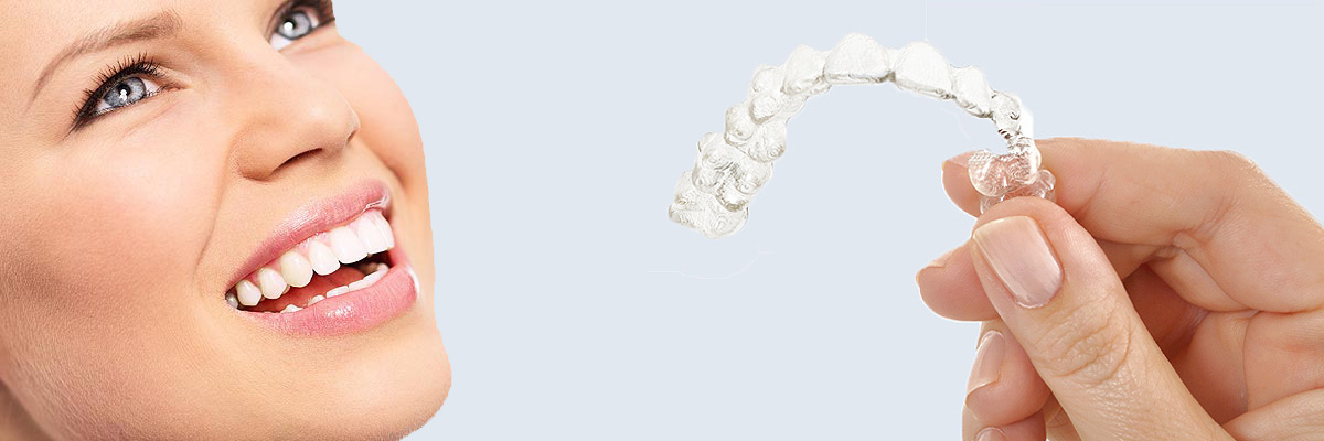 Englewood 7 Things Parents Need to Know About Invisalign Teen