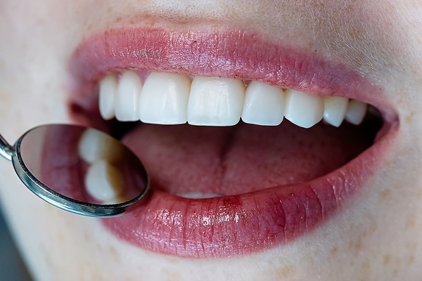 Periodontics: What Is Crown Lengthening?