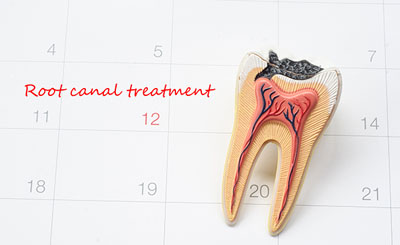 A Root Canal Therapy Can Save Your Infected Tooth