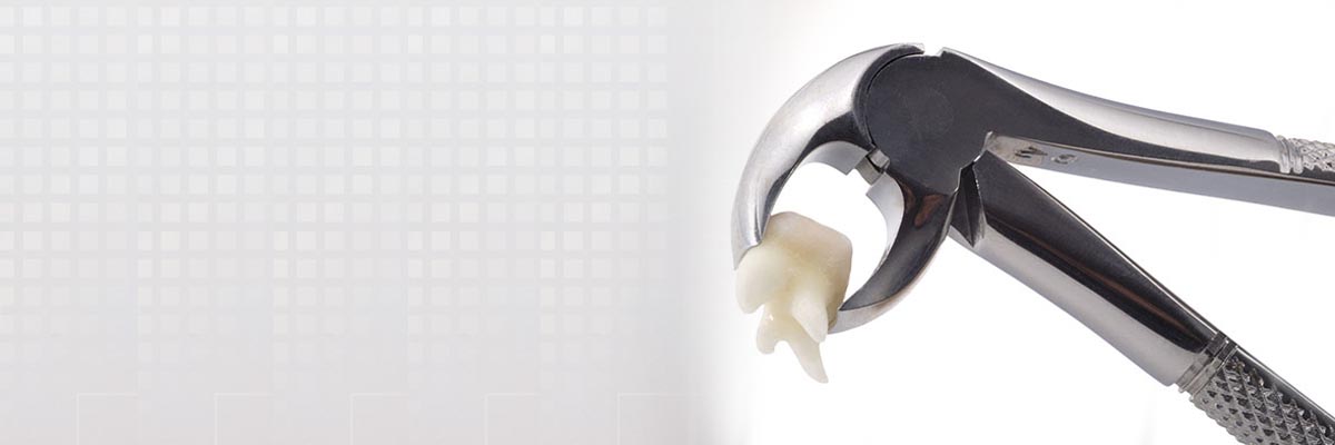 Englewood Tooth Extraction
