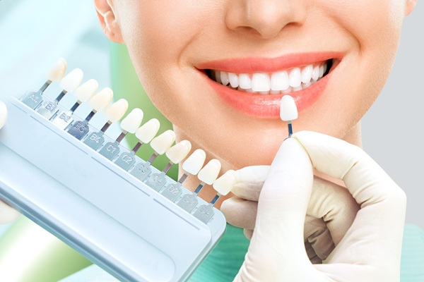 Signs You Could Benefit From Seeing A Veneers Dentist